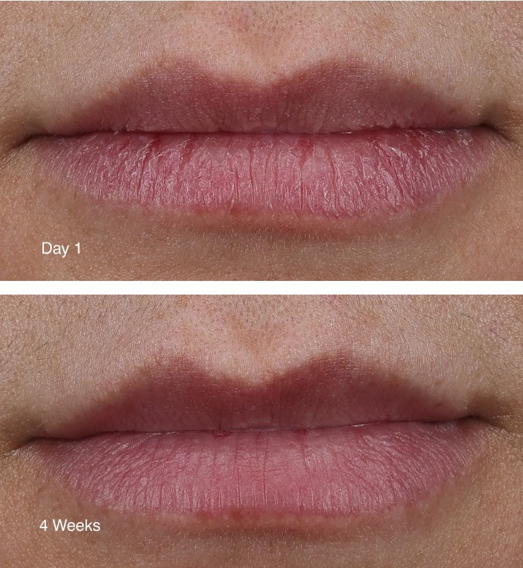 Rhode-Peptide Lip Treatment