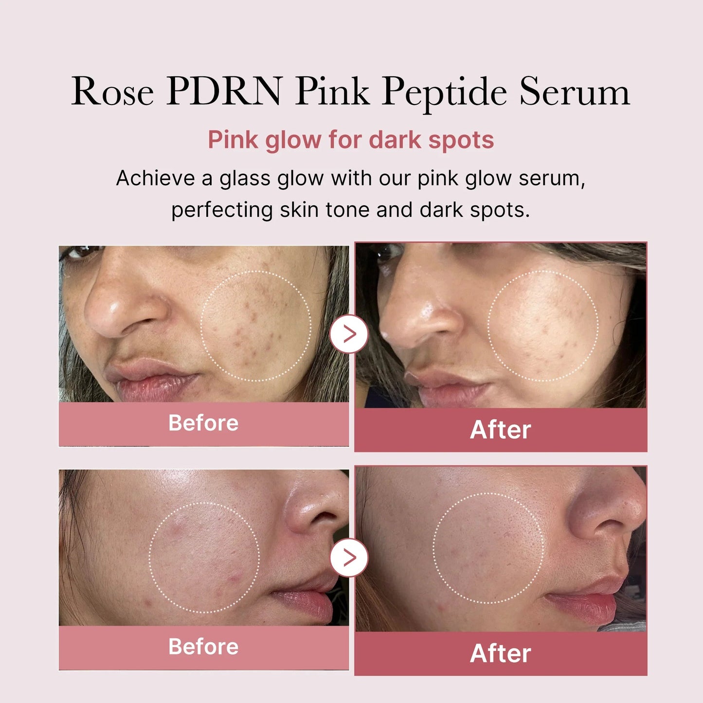 Medicube-PDRN Pink Peptide Serum 30ml